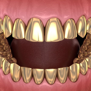 Zahnprothese Gold Foto iStock alex-mit